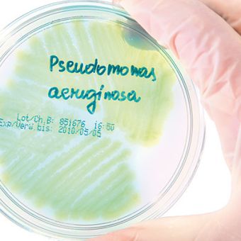 Pseudomonas aeruginosa